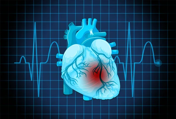 Ilustración Del Símbolo Enfermedad Cardíaca Humana — Vector de stock