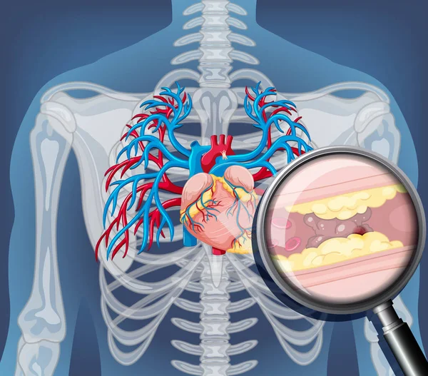 Röntgen Människokroppen Med Inre Organ Illustration — Stock vektor