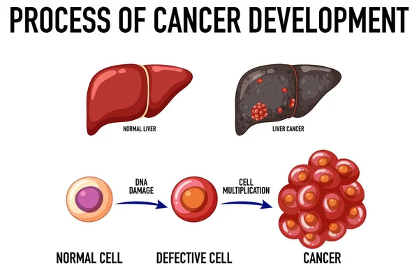 Diagram Showing Process Cancer Development Illustration — Wektor stockowy