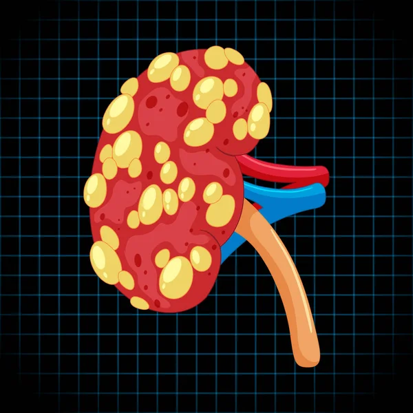 Human Internal Organ Kidney Illustration — Stok Vektör