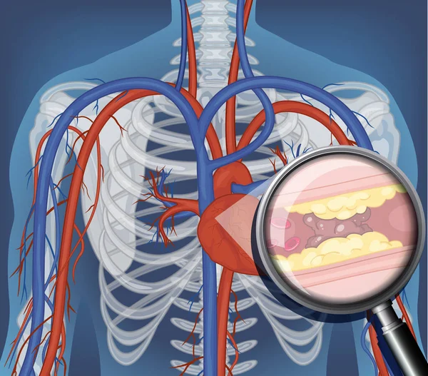 Radiografía Del Cuerpo Humano Con Ilustración Órganos Internos — Vector de stock
