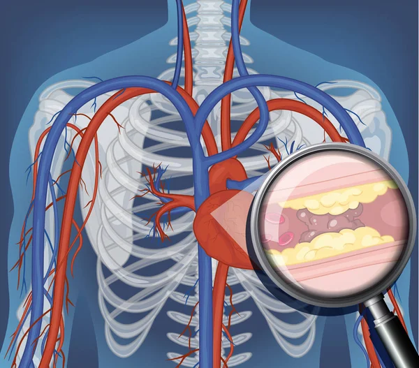 Röntgen Människokroppen Med Inre Organ Illustration — Stock vektor