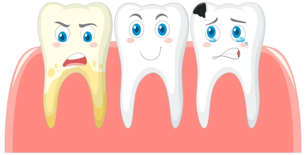 白い背景のイラストの歯科と異なる歯の状態 — ストックベクタ