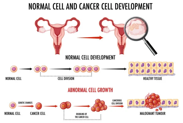 显示正常细胞和癌细胞的示意图 — 图库矢量图片