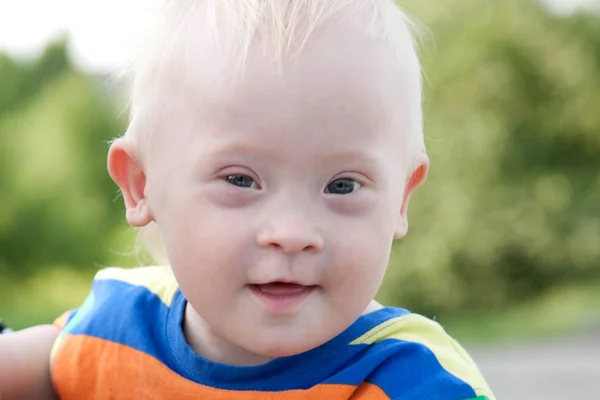 Bebê com síndrome de Down — Fotografia de Stock