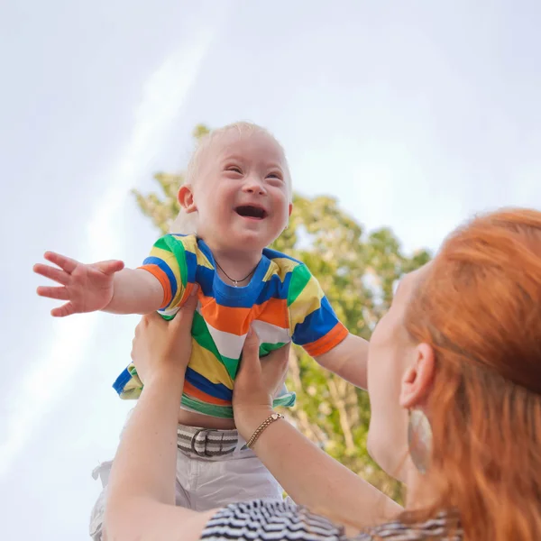 Bebê com síndrome de Down — Fotografia de Stock