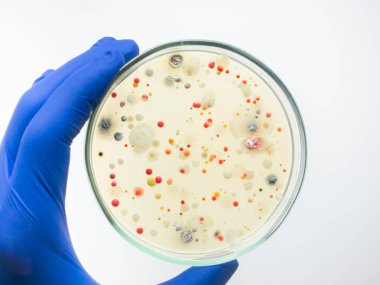 Besin kabında bir insandan farklı bakteri kolonileri. Bilim adamı Petri kabını elinde tutuyor. Yakından..