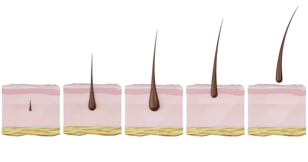 Illustratie Van Stadia Van Herstelcyclus Haargroei Haaruitval Kaalheid Alopecia Ontharing Stockafbeelding