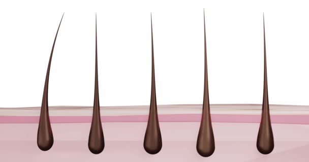 Animace Odstranění Vlasů Kořene Vlasový Folikul Odstranění Vlasů Vypadávání Vlasů — Stock video