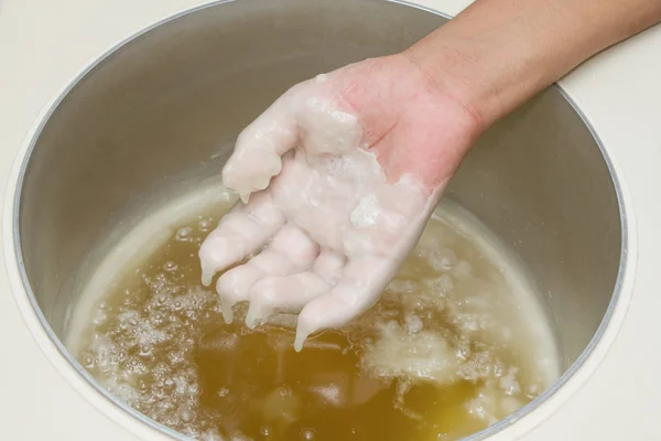 Tratamiento de fisioterapia y belleza, Mano en baño de parafina — Foto de Stock