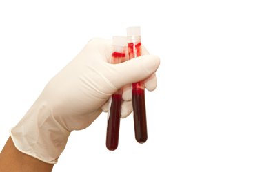 Doktor el ile kan testi tüpler yolu ile beyaz izole