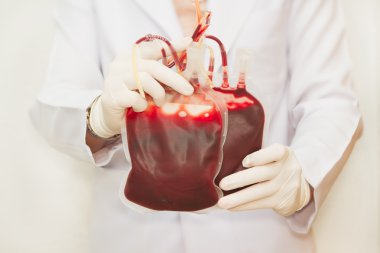 taze donör kan nakli için tutan doktor