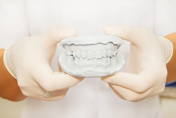 牙科石膏模型石膏的牙医手无 — 图库照片