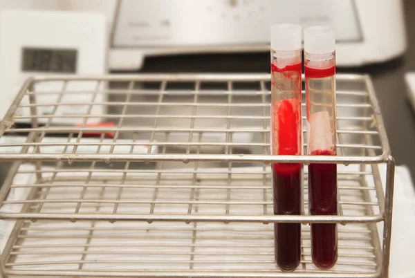Tubo de teste com sangue para análise — Fotografia de Stock