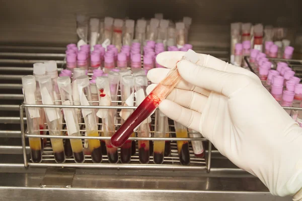 Médico mão segurar tubos de teste de sangue — Fotografia de Stock