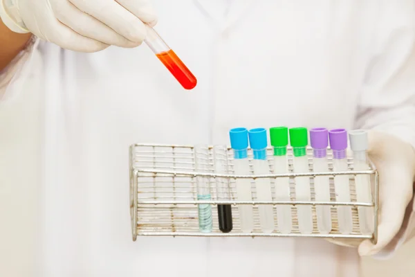 Main d'un scientifique prenant un tube d'échantillon de sang — Photo