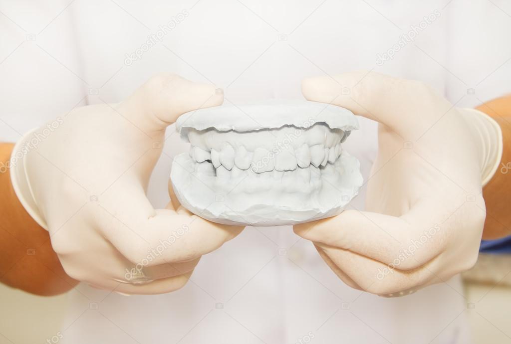 Dental gypsum model plaster with dentist hand grapping Stock Photo by