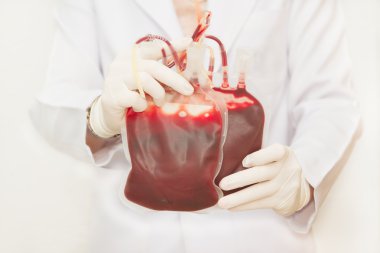 taze donör kan nakli için tutan doktor
