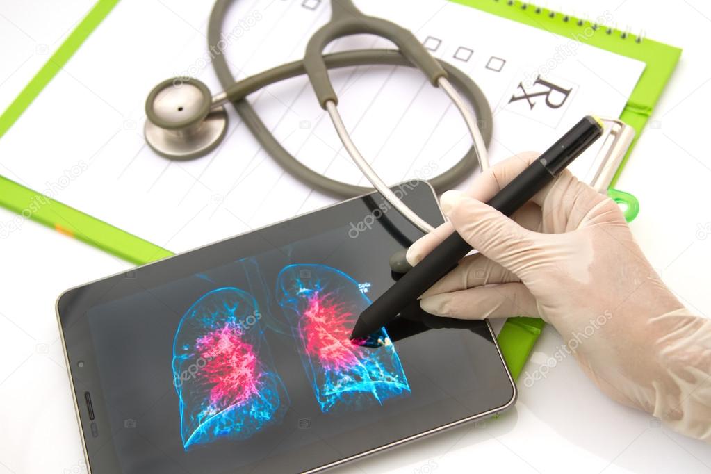 Doctor looking chest x-ray image on tablet for medical exam (Ima