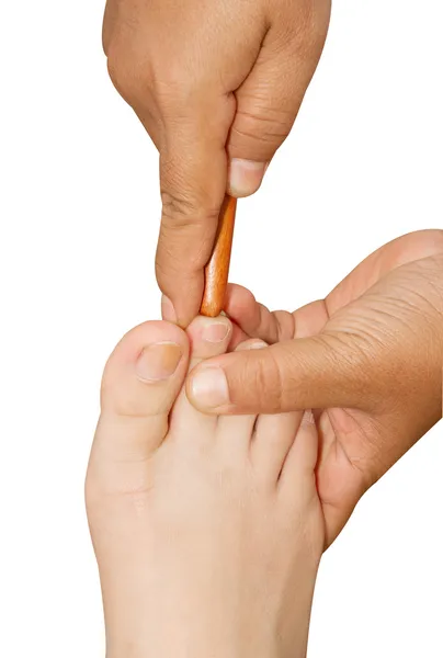 Reflexology foot massage, thai spa foot treatment by wood stick — Stock Photo, Image