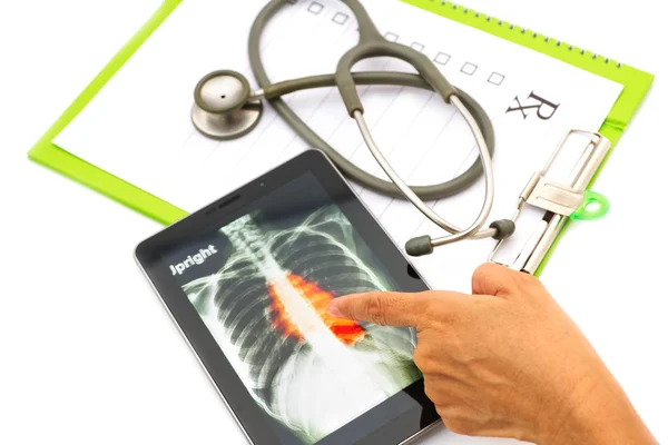 Médico olhando radiografia de tórax em tablet para exame médico — Fotografia de Stock