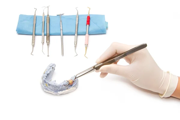 Dental prosthesis on gypsum model plaster with dental tool — Stock Photo, Image