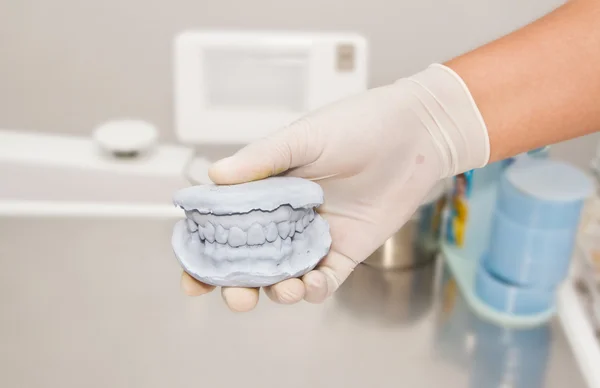 Tandheelkundige gips model gips met arts hand grapping — Stockfoto