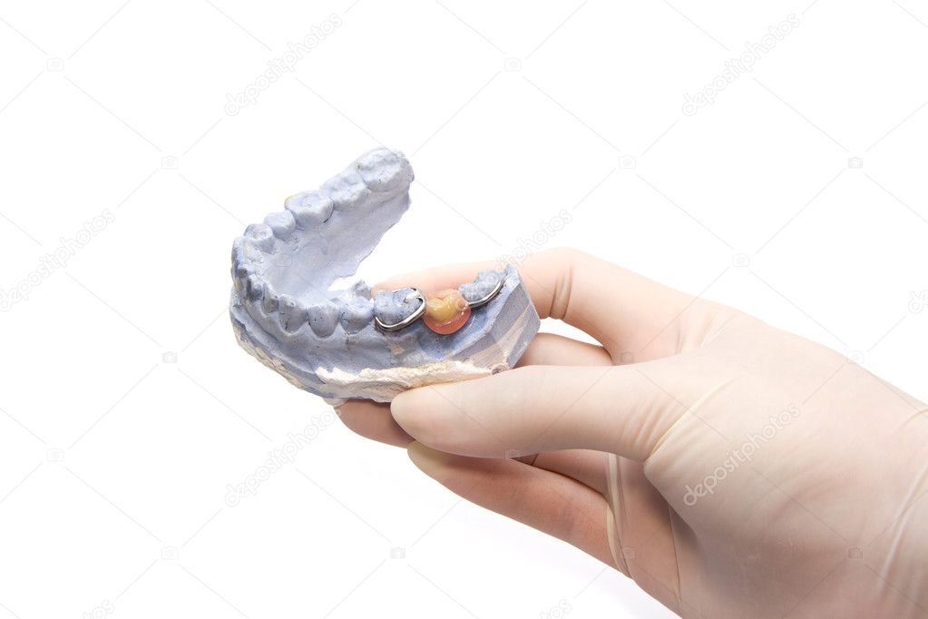Dental prosthesis on gypsum model plaster with doctor hand grapp