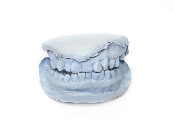 石膏模型的人类的牙齿 — 图库照片
