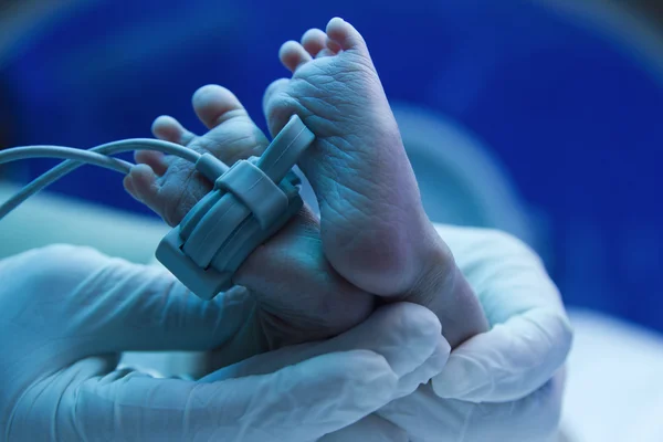 Soins des mains du médecin pour un nouveau-né malade en soins intensifs pédiatriques — Photo