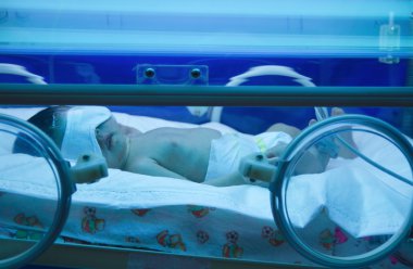 Kuvözde ultraviyole lamba altında yeni doğan bebek