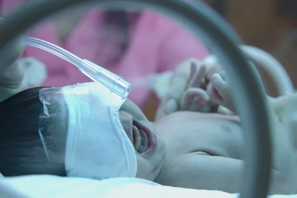 Premature baby with oxyzen under ultraviolet lamp in the incuba — Stock Photo, Image