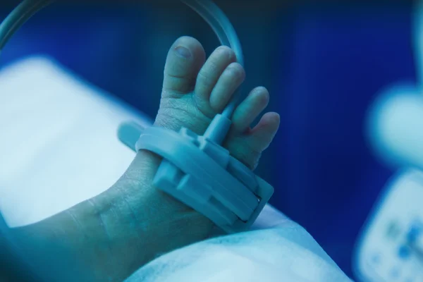 Premature baby foot under ultraviolet lamp in the incubator — Stock Photo, Image