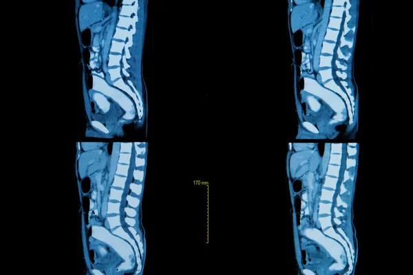 Computer tomography of  human body Stock Image