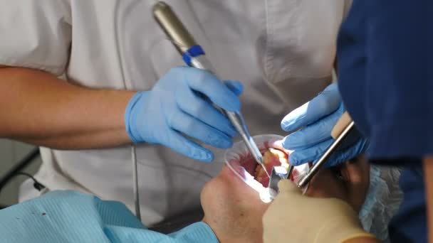 Clinique dentaire moderne. Gros plan. Chirurgien dentiste professionnel traitant les canaux radiculaires, extrayant les dents ou installant des implants dentaires. Médecin et assistant portent une combinaison de protection et des gants — Video