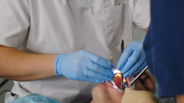 Modern dental clinic. Close-up. Professional dentist surgeon treating root canals, extracting tooth or installing dental implants. Doctor and assistant wear protective suit and gloves working on — Stock Video