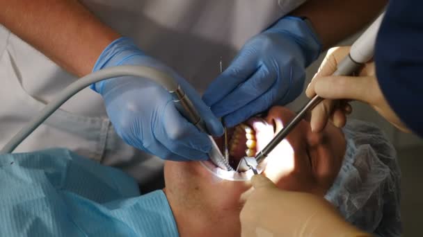 Modern tandläkarmottagning. Närbild. Professionell tandläkare kirurg behandla rotkanaler, extrahera tand eller installera tandimplantat. Läkare och assistent bära skyddsdräkt och handskar arbetar på — Stockvideo