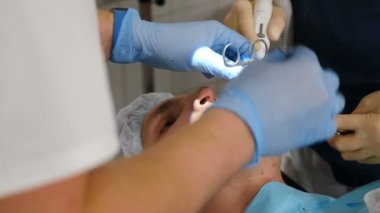 Modern dişçilikte cerrahi operasyon. Dişçiler diş implantı takarak ya da çürük diş çıkararak cerrahi tedavi uyguluyorlar. Doktorlar koruyucu elbiseler giyer ve hasta dişlerinde eldiven takarlar.
