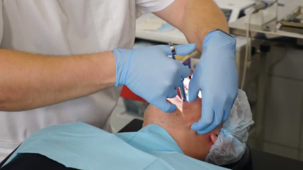 Modern dişçilikte cerrahi operasyon. Dişçiler diş implantı takarak ya da çürük diş çıkararak cerrahi tedavi uyguluyorlar. Doktorlar koruyucu elbiseler giyer ve hasta dişlerinde eldiven takarlar. — Stok video