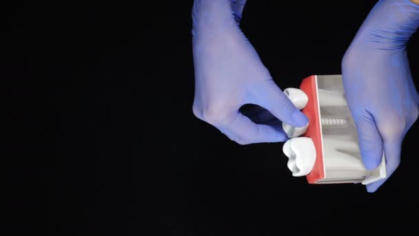 Dents humaines dentaires concept tourné sur fond noir. Extraction des dents. Perte de la dent molaire montrée sur le modèle de dents tenu par les mains féminines dans des gants bleus. Images verticales. Vidéo 4 k — Video