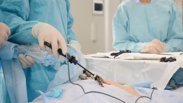 Ameliyat odası, laparoskopik müdahale yapan cerrahlar. Modern tıp, hastanede tıbbi malzemeler. Laparoskop aletleri. Doktorlar endo-enstrüman ve video kamera kullanır. 4 bin. — Stok video