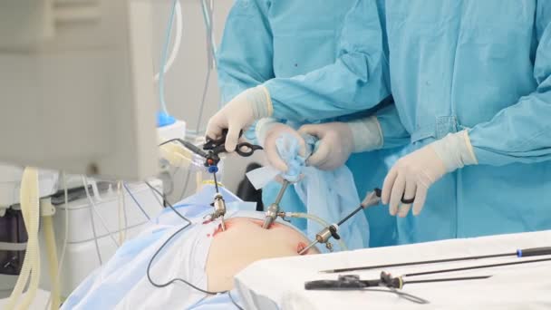 Operační sál, tým chirurgů provádějících laparoskopický zákrok. Moderní medicína, lékařské vybavení v nemocnici. Laparoskopické nástroje a ruce. Doktoři používají endo-nástroje a videokamery. 4 k — Stock video