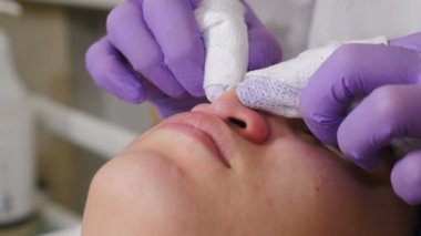 Güzellik uzmanı yüzünü mekanik olarak temizliyor. Kozmetik uzmanı yüzdeki sivilceleri parmaklarıyla sıkıyor. Deri bakımı prosedürü. Klinikte sivilce ve sivilce tedavisi. Sorunlu cilt. 4 k video