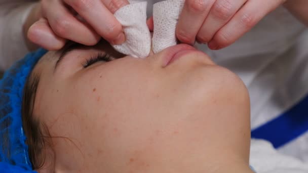 Beautician κάνει πρόσωπο μηχανικό καθαρισμό. Cosmetologist συμπίεση ακμή στη μύτη του δέρματος του προσώπου με τα δάχτυλα. Διαδικασία περιποίησης δέρματος. Θεραπεία με ακμή και σπυράκια δέρματος στην κλινική. προβληματικό δέρμα. 4 k βίντεο — Αρχείο Βίντεο