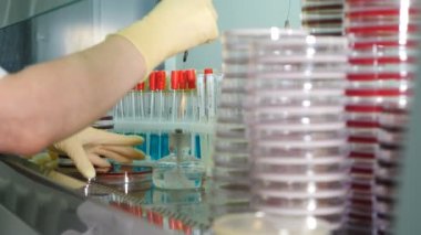 Sağlık ve insan sağlığı analizleri. Kültür gönderin. Laboratuvarı olan modern bir klinik. Petri kabında genetiği değiştirilmiş organizmaları kontrol eden bir uzman, filizlenmiş tahıl örneğiyle çalışan biyoloji araştırmacısı