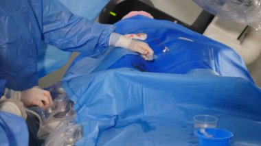 Damar ameliyatı. Radyolog anjiyografi makinesiyle endovasküler ameliyat yapıyor. Doktor rahim fibroid embolizasyonu için kontrast sıvısı kullanıyor. Kardiyo-vasküler muayene. 4k video