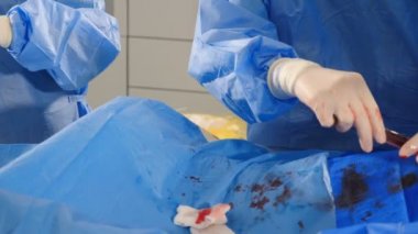 Vascular surgery in modern clinic. Professional doctors in surgical gowns and gloves carrying out operation on veins using latest technology. Heart disease. Cardio-vascular examination. operation