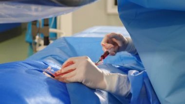 Vascular surgery in modern clinic. Professional doctors in surgical gowns and gloves carrying out operation on veins using latest technology. Heart disease. Cardio-vascular examination. operation