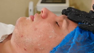 Beautician applying acid peeling solution on male client face rubbing with black gloved hands. Skin care and procedures for problematic skin. Young man getting facial treatment in beauty clinic. 4 k