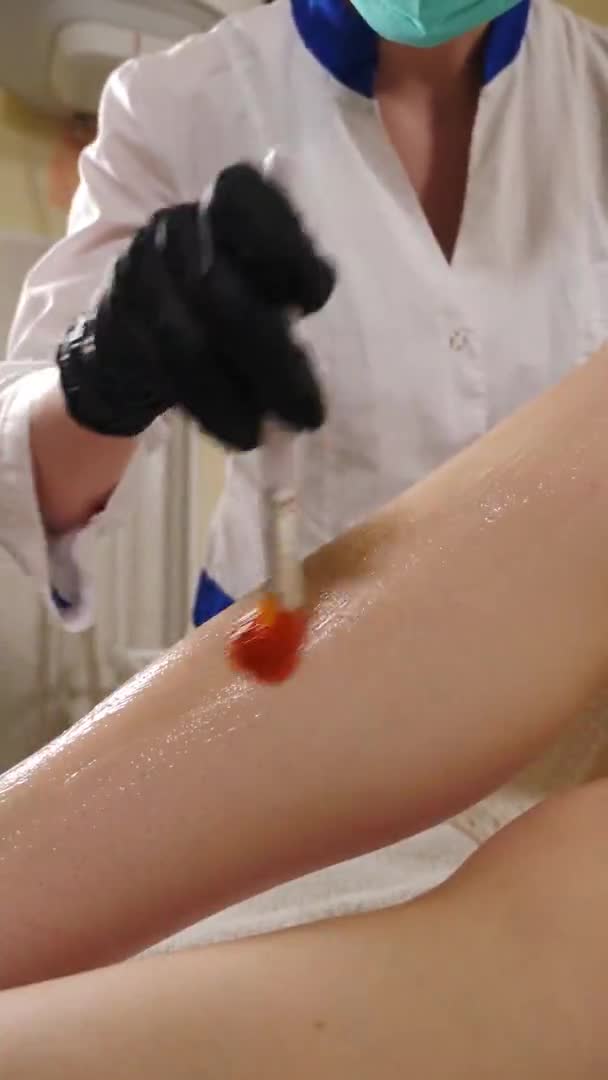 Beautician applies transparent gel on female leg before hair removal. Vertical footage. Removing unwanted body hair. Beauty procedure. Laser epilation in beauty spa clinic. photoepilation, body skin — Stockvideo